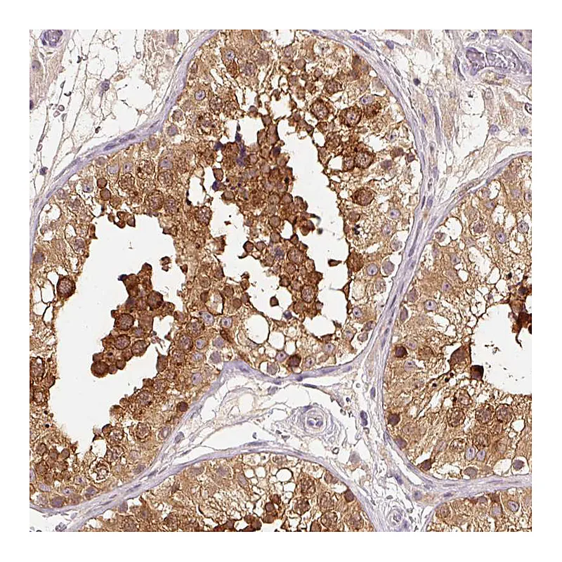 Atlas Antibodies Anti-HERC2 Antibody