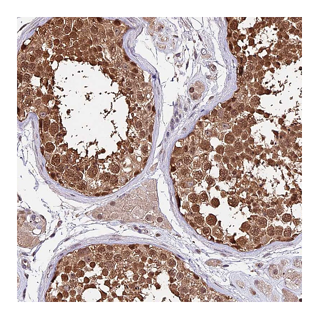 Atlas Antibodies Anti-HERPUD1 Antibody