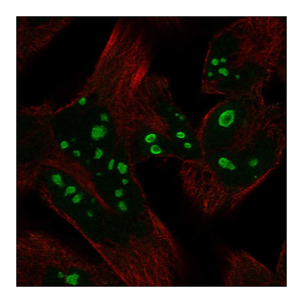 Atlas Antibodies Anti-HERPUD2 Antibody