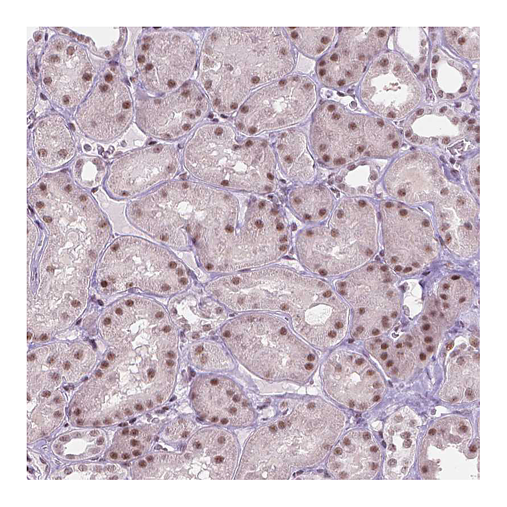 Atlas Antibodies Anti-HES7 Antibody