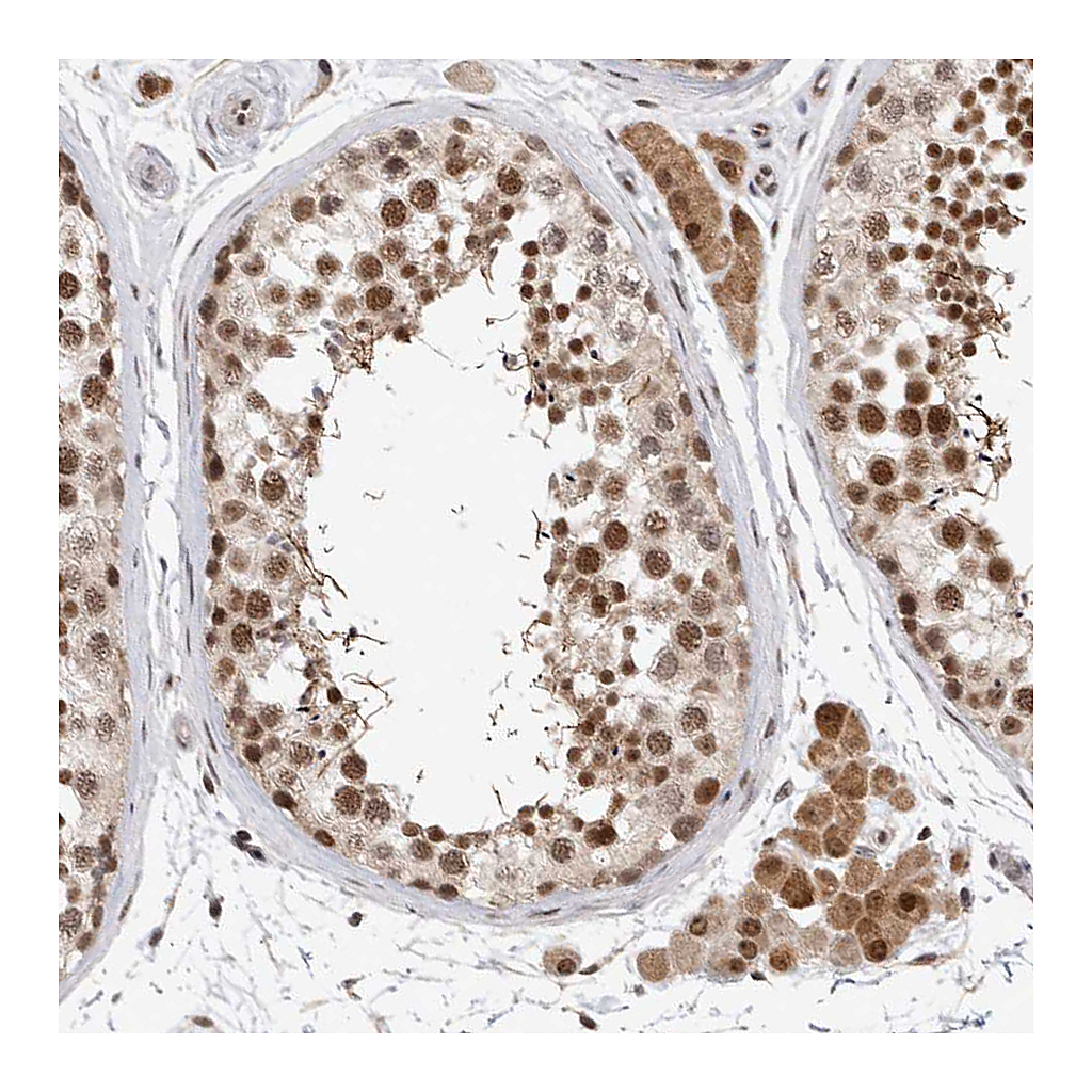 Atlas Antibodies Anti-HESX1 Antibody