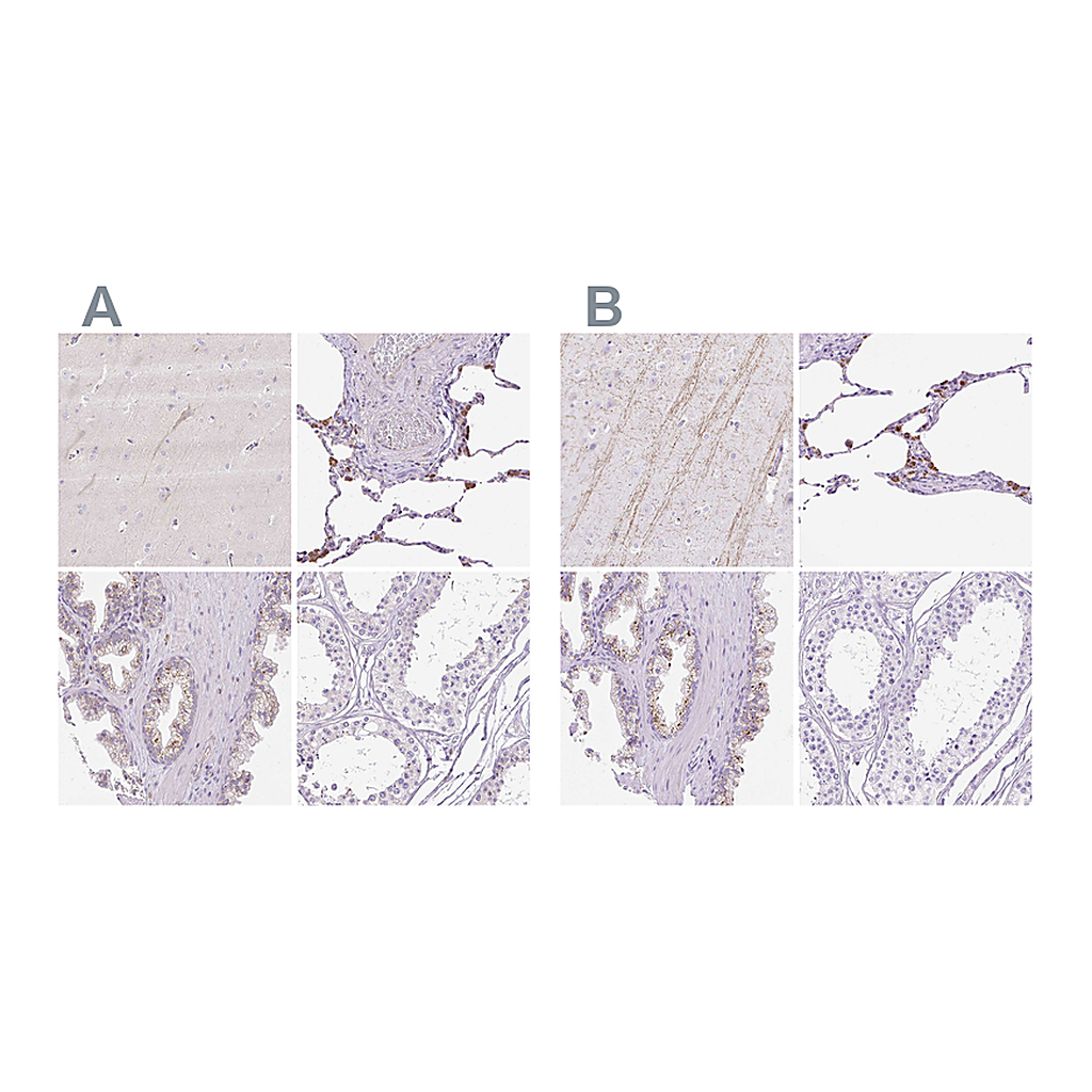 Atlas Antibodies Anti-HEXB Antibody