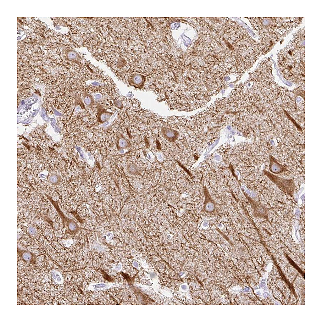 Atlas Antibodies Anti-HEY1 Antibody