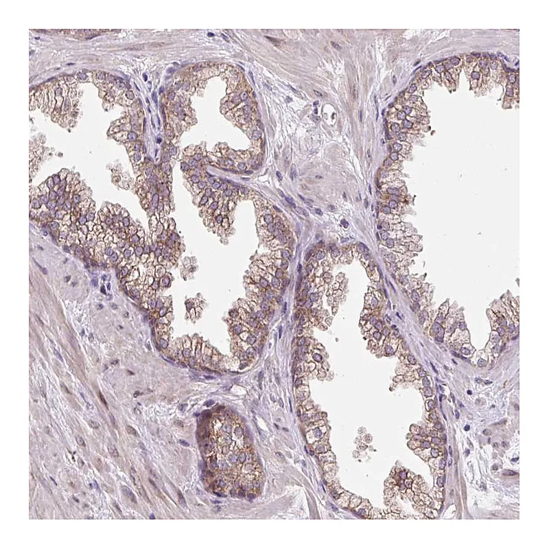 Atlas Antibodies Anti-HFE Antibody