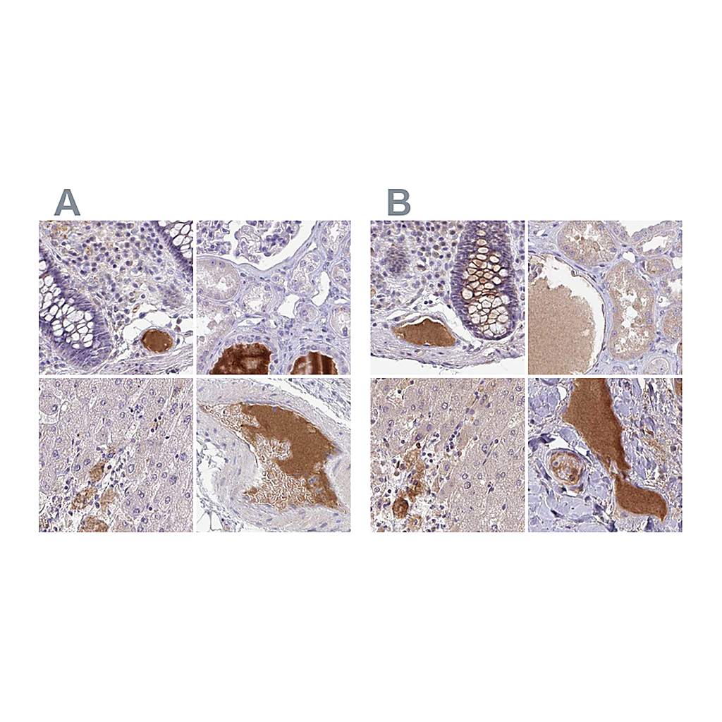 Atlas Antibodies Anti-HGFAC Antibody