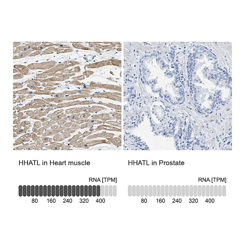 Atlas Antibodies Anti-HHATL Antibody