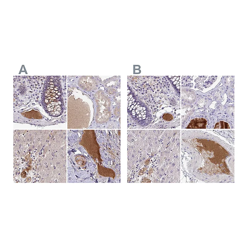 Atlas Antibodies Anti-HGFAC Antibody