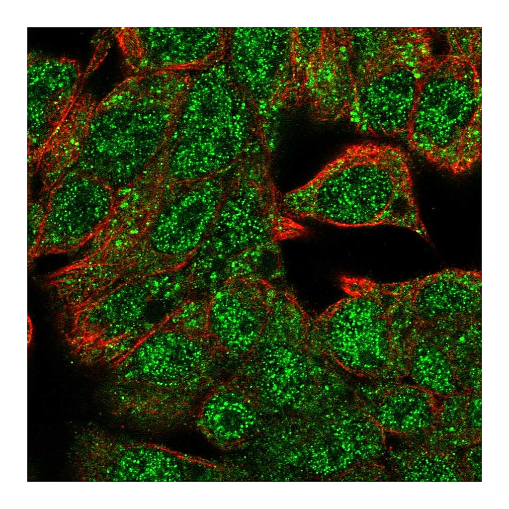 Atlas Antibodies Anti-HHEX Antibody