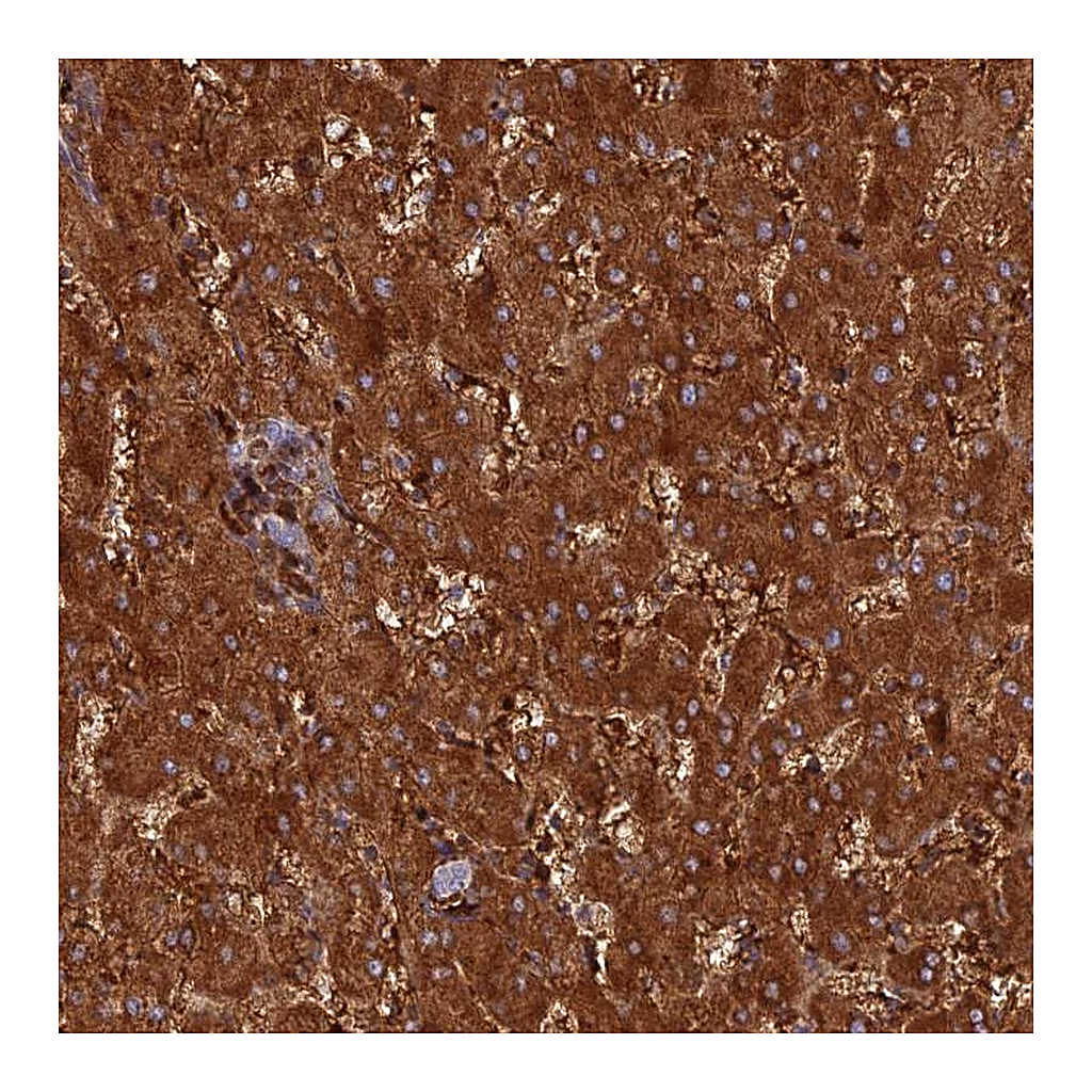 Atlas Antibodies Anti-HHAT Antibody