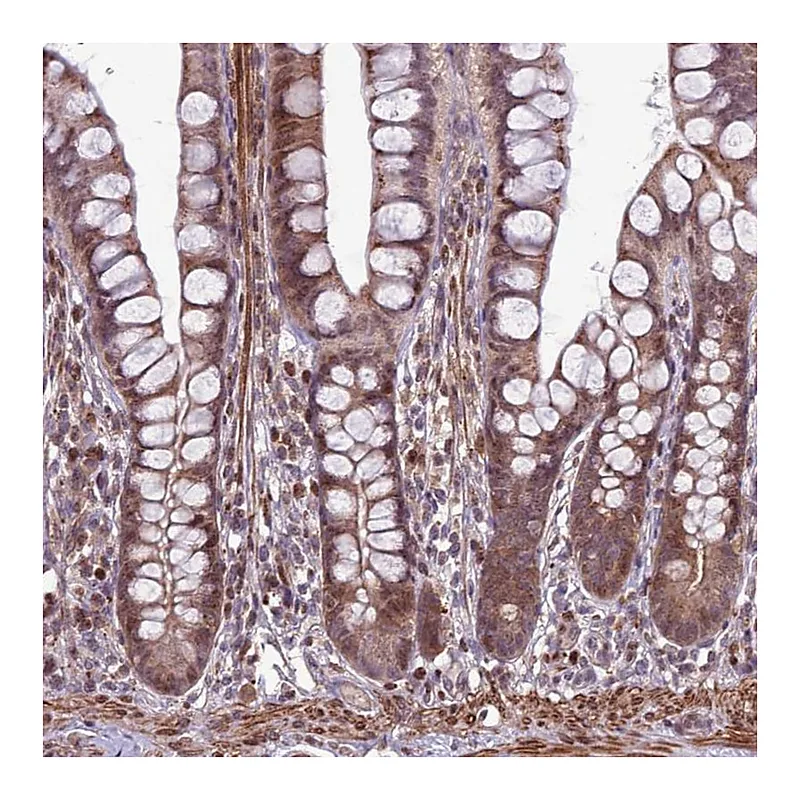 Atlas Antibodies Anti-HGH1 Antibody