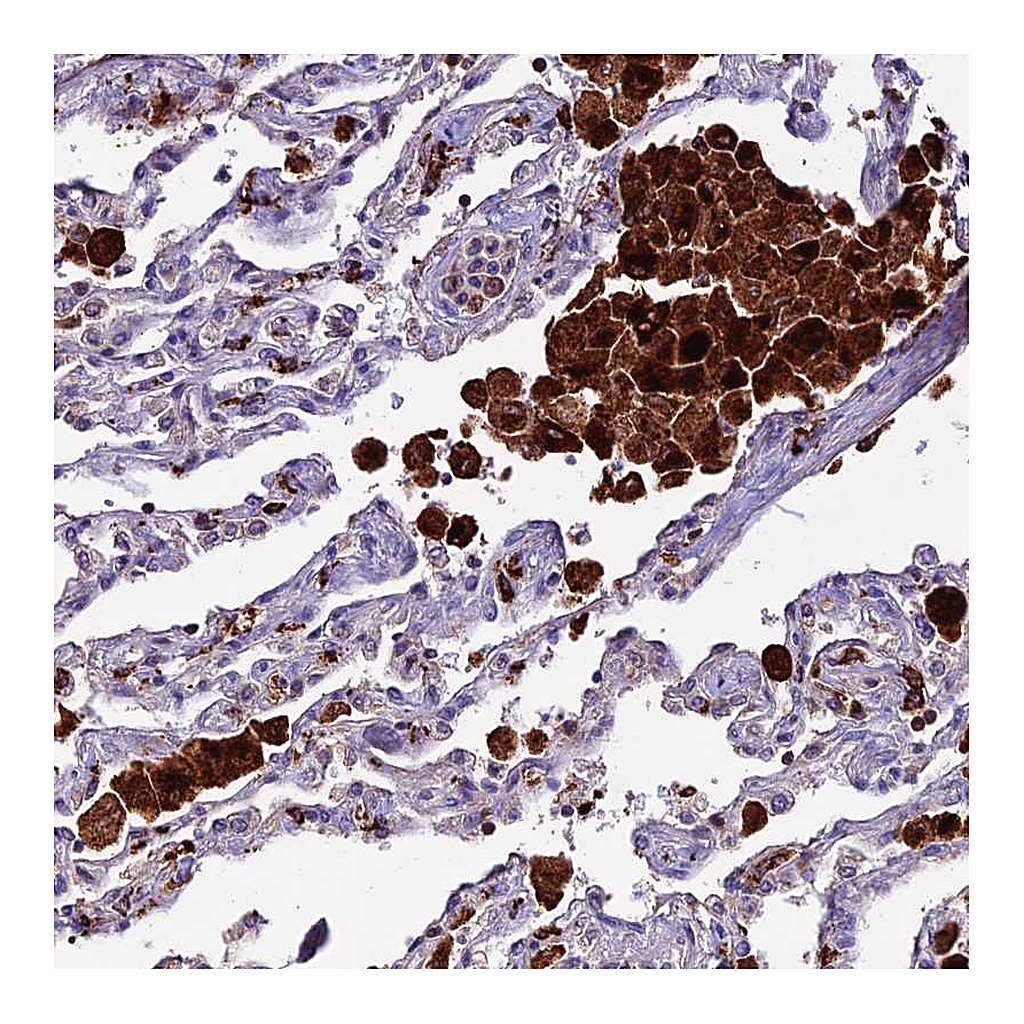 Atlas Antibodies Anti-HIC1 Antibody