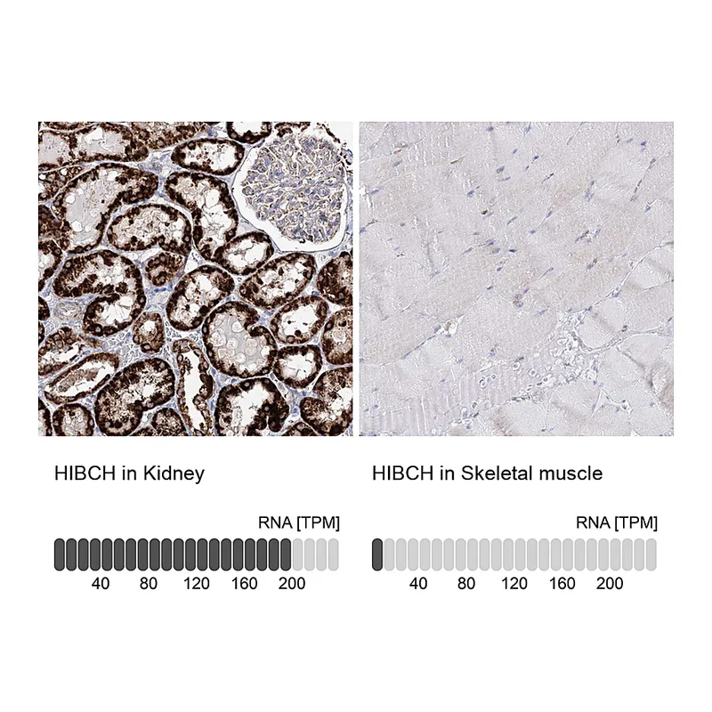 Atlas Antibodies Anti-HIBCH Antibody