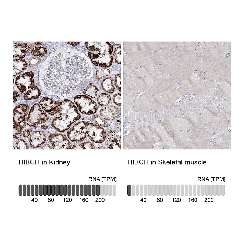 Atlas Antibodies Anti-HIBCH Antibody