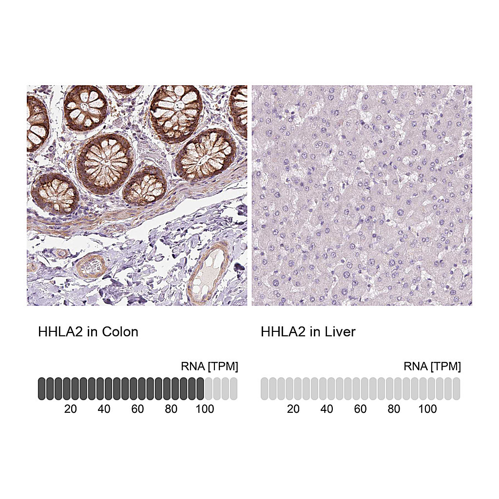 Atlas Antibodies Anti-HHLA2 Antibody