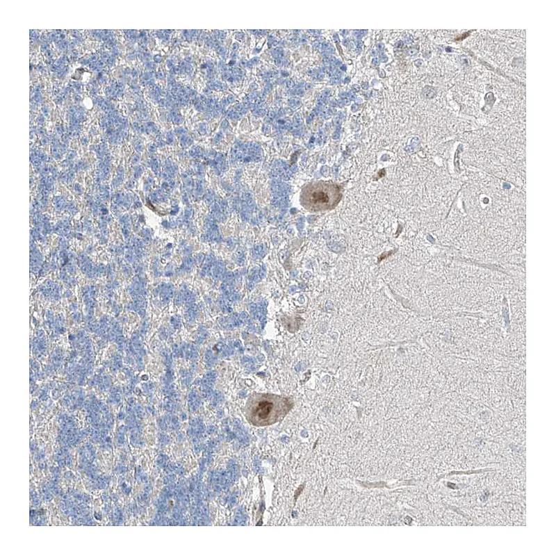 Atlas Antibodies Anti-HIC2 Antibody