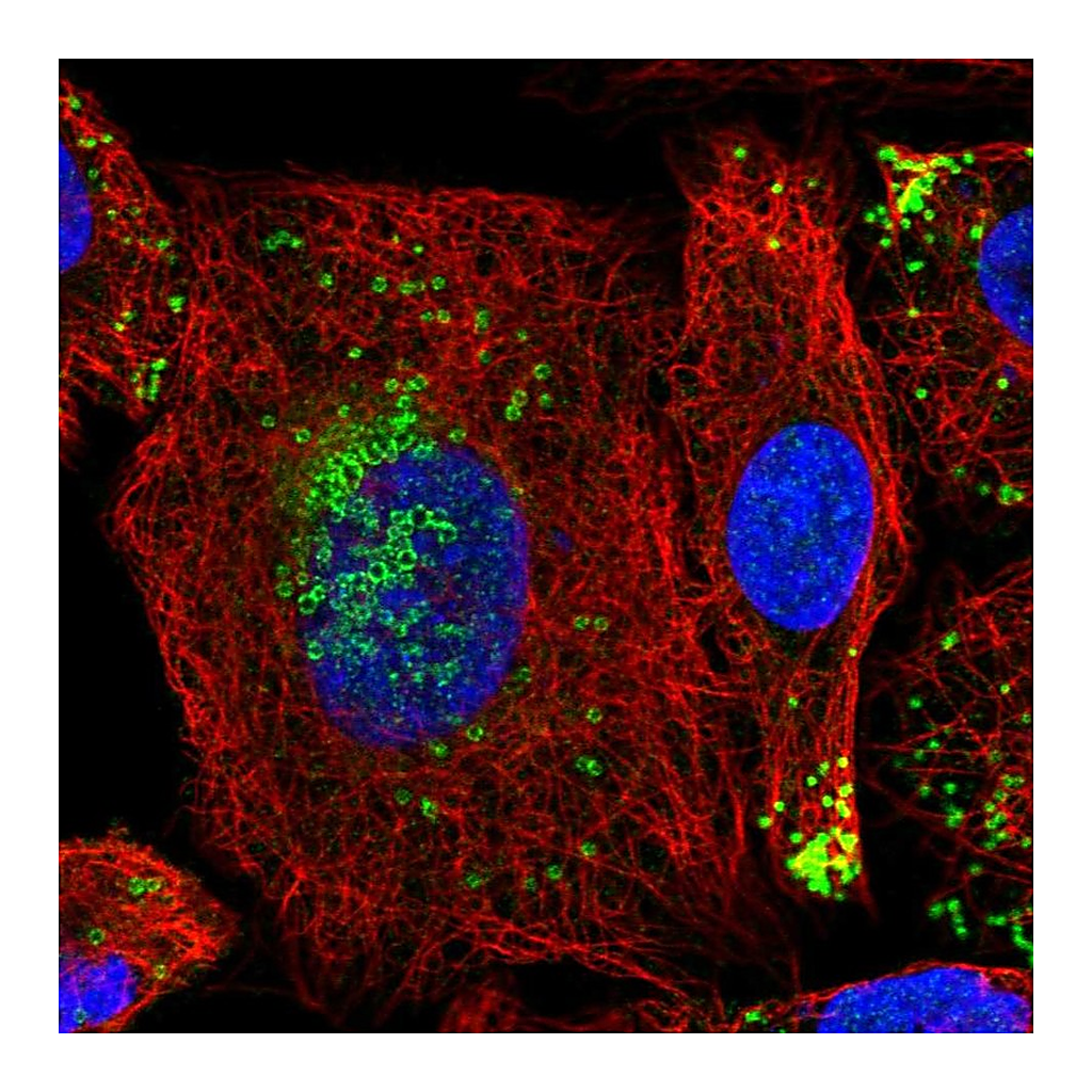 Atlas Antibodies Anti-HILPDA Antibody