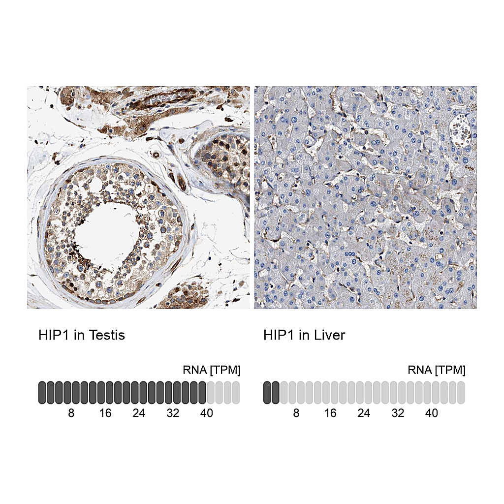 Atlas Antibodies Anti-HIP1 Antibody