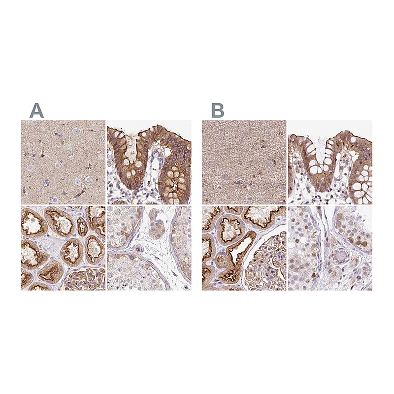 Atlas Antibodies Anti-HIP1R Antibody