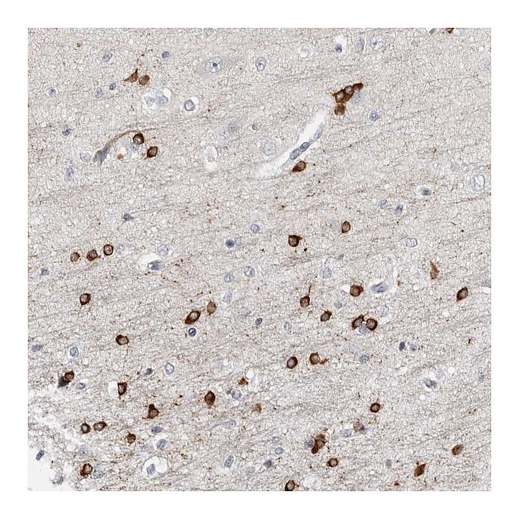 Atlas Antibodies Anti-HIPK4 Antibody