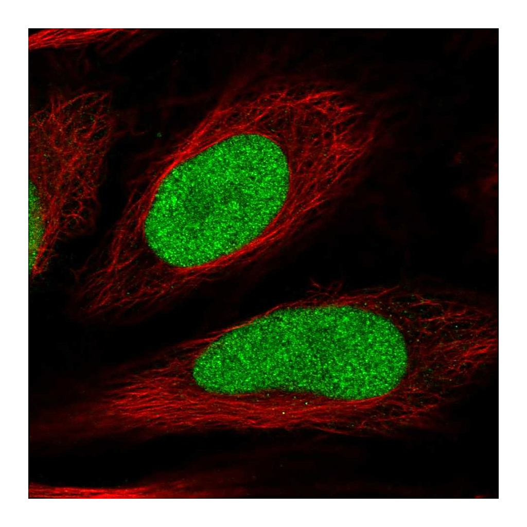Atlas Antibodies Anti-HIRIP3 Antibody