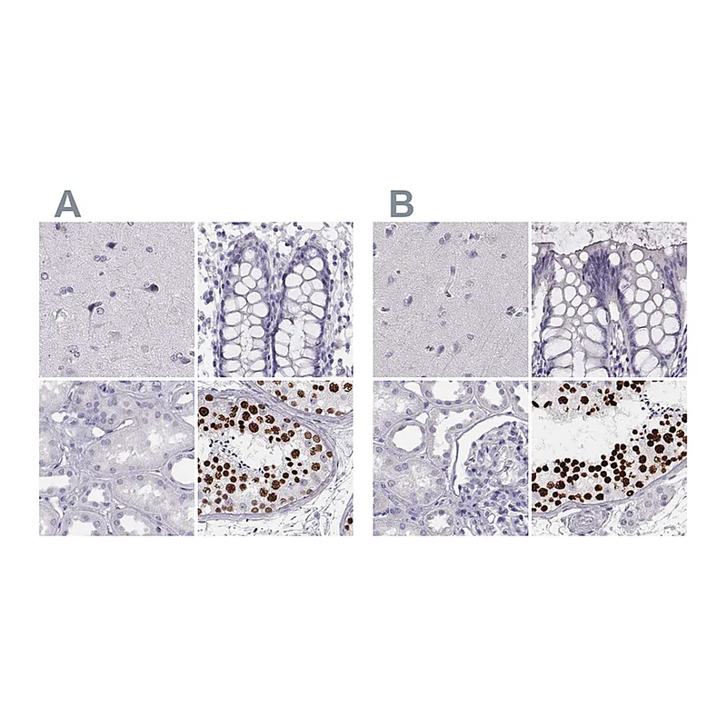 Atlas Antibodies Anti-HIST1H1T Antibody