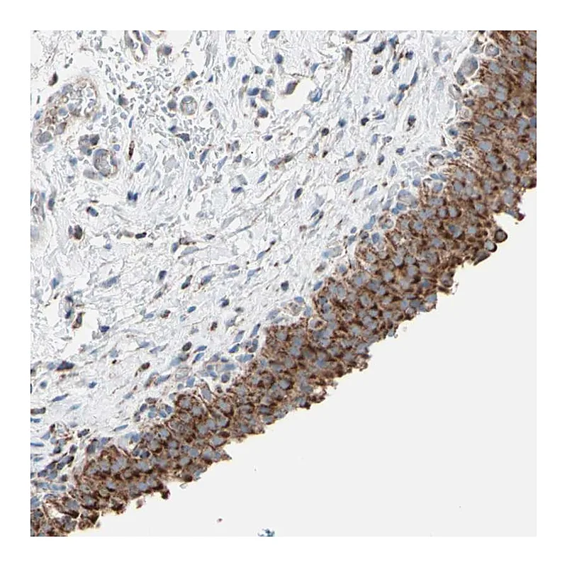 Atlas Antibodies Anti-HK1 Antibody