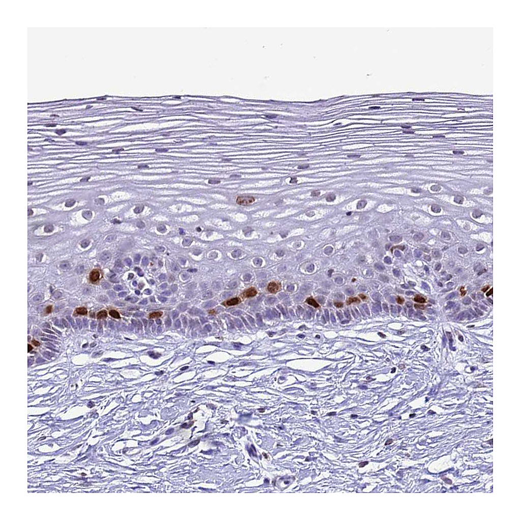 Atlas Antibodies Anti-HIST4H4 Antibody