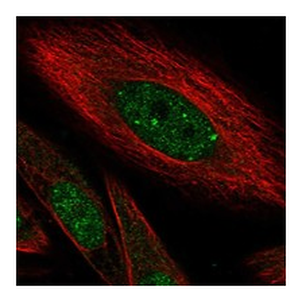 Atlas Antibodies Anti-HIVEP1 Antibody