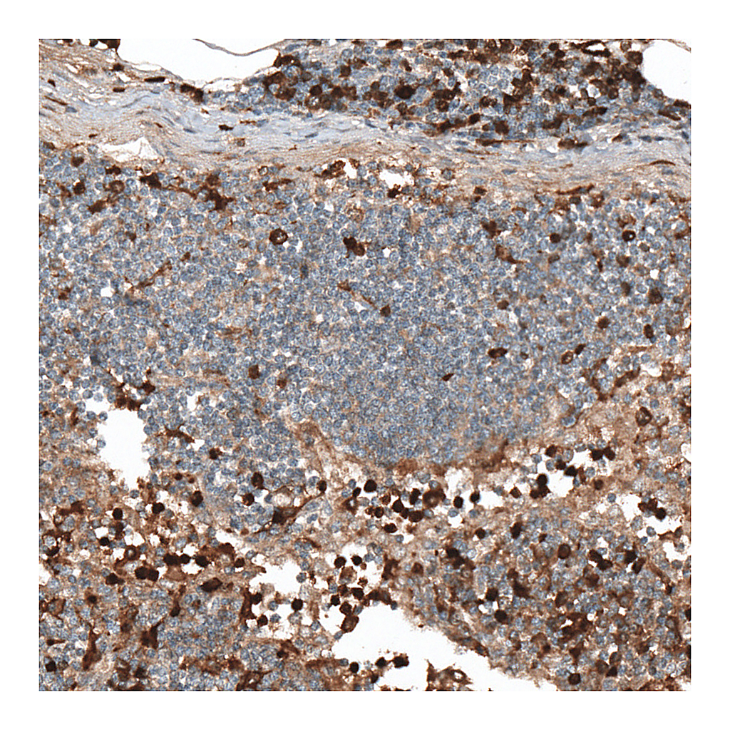 Atlas Antibodies Anti-HJURP Antibody