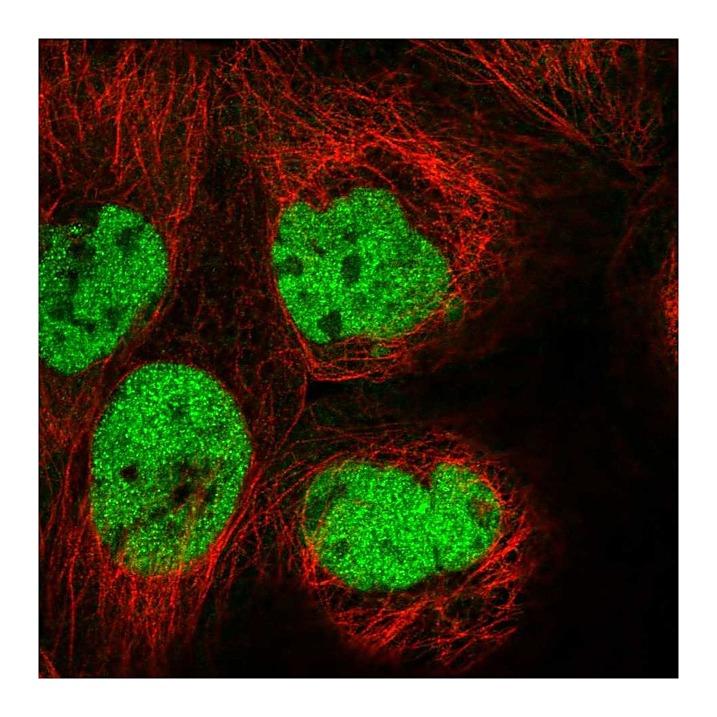 Atlas Antibodies Anti-HIVEP3 Antibody