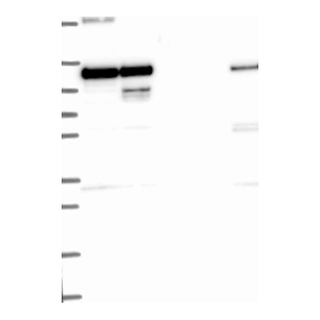 Atlas Antibodies Anti-HK2 Antibody