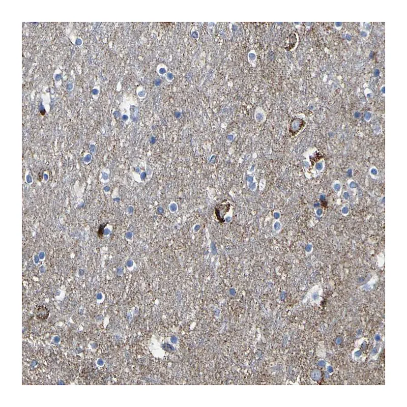 Atlas Antibodies Anti-HK1 Antibody