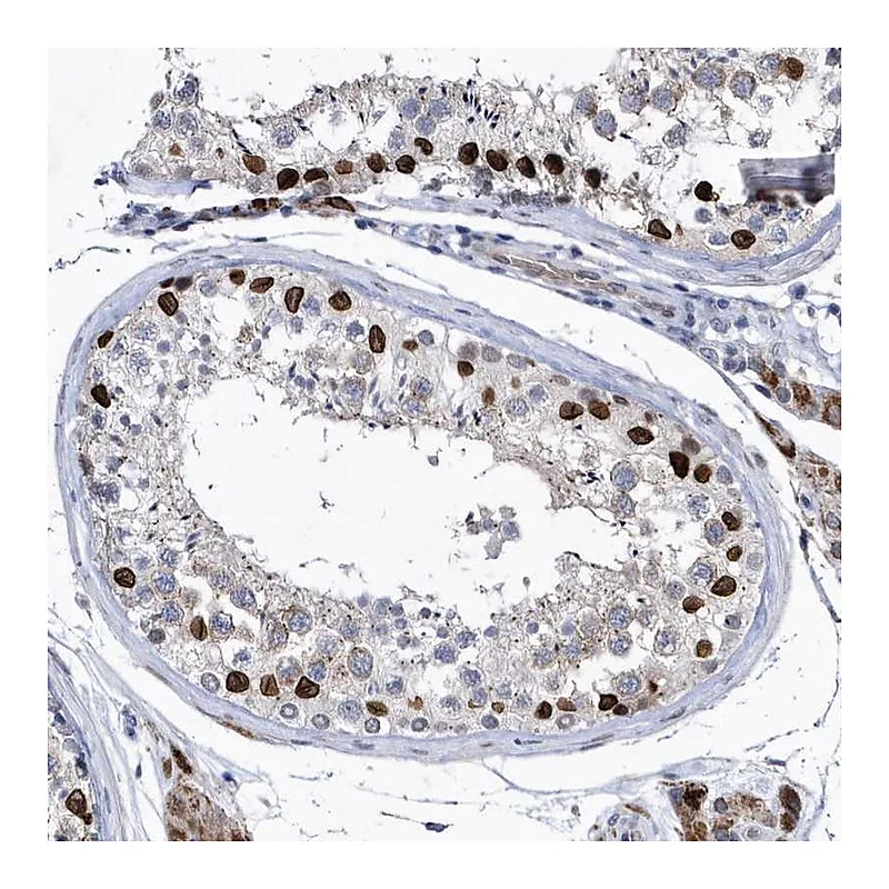 Atlas Antibodies Anti-HKR1 Antibody