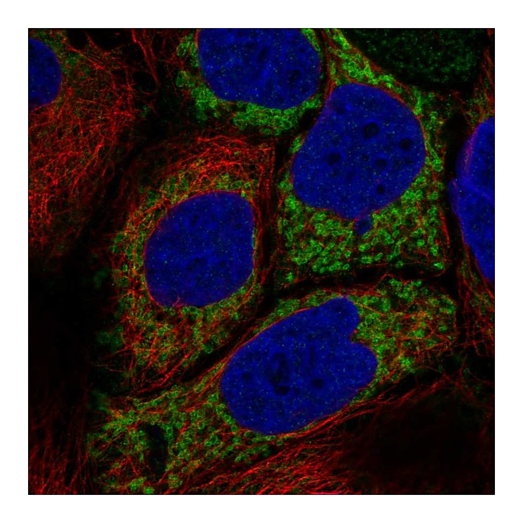Atlas Antibodies Anti-HKDC1 Antibody