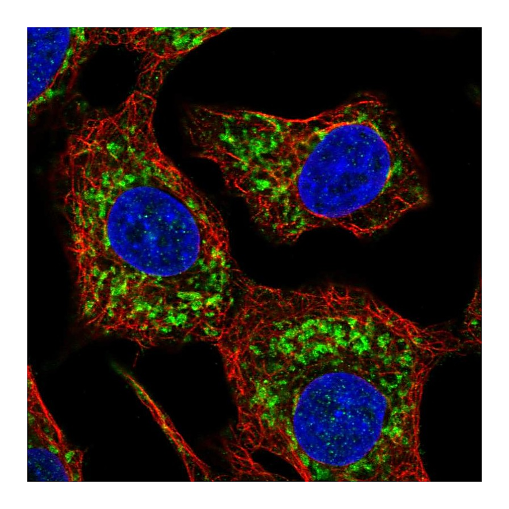 Atlas Antibodies Anti-HKDC1 Antibody