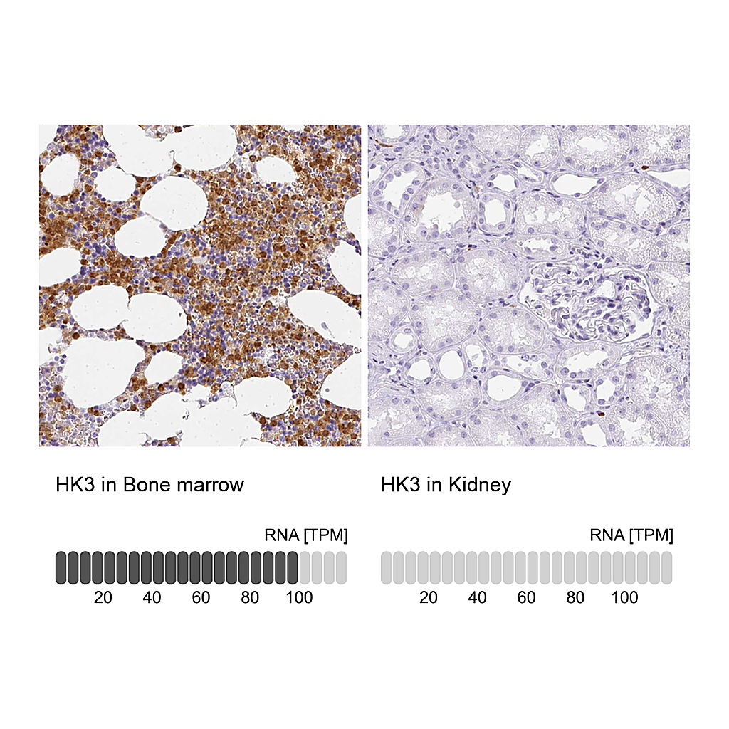 Atlas Antibodies Anti-HK3 Antibody