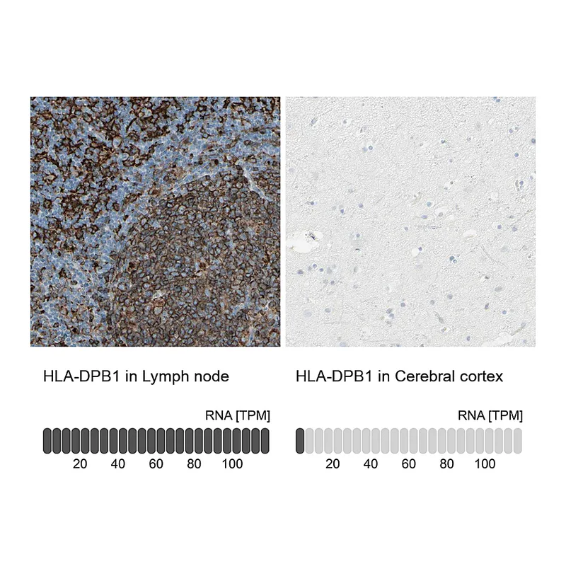 Atlas Antibodies Anti-HLA-DPB1 Antibody