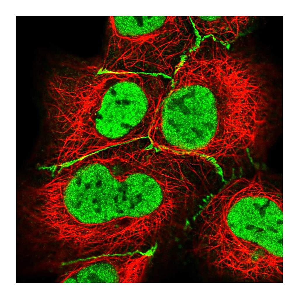 Atlas Antibodies Anti-HLA-DPB1 Antibody