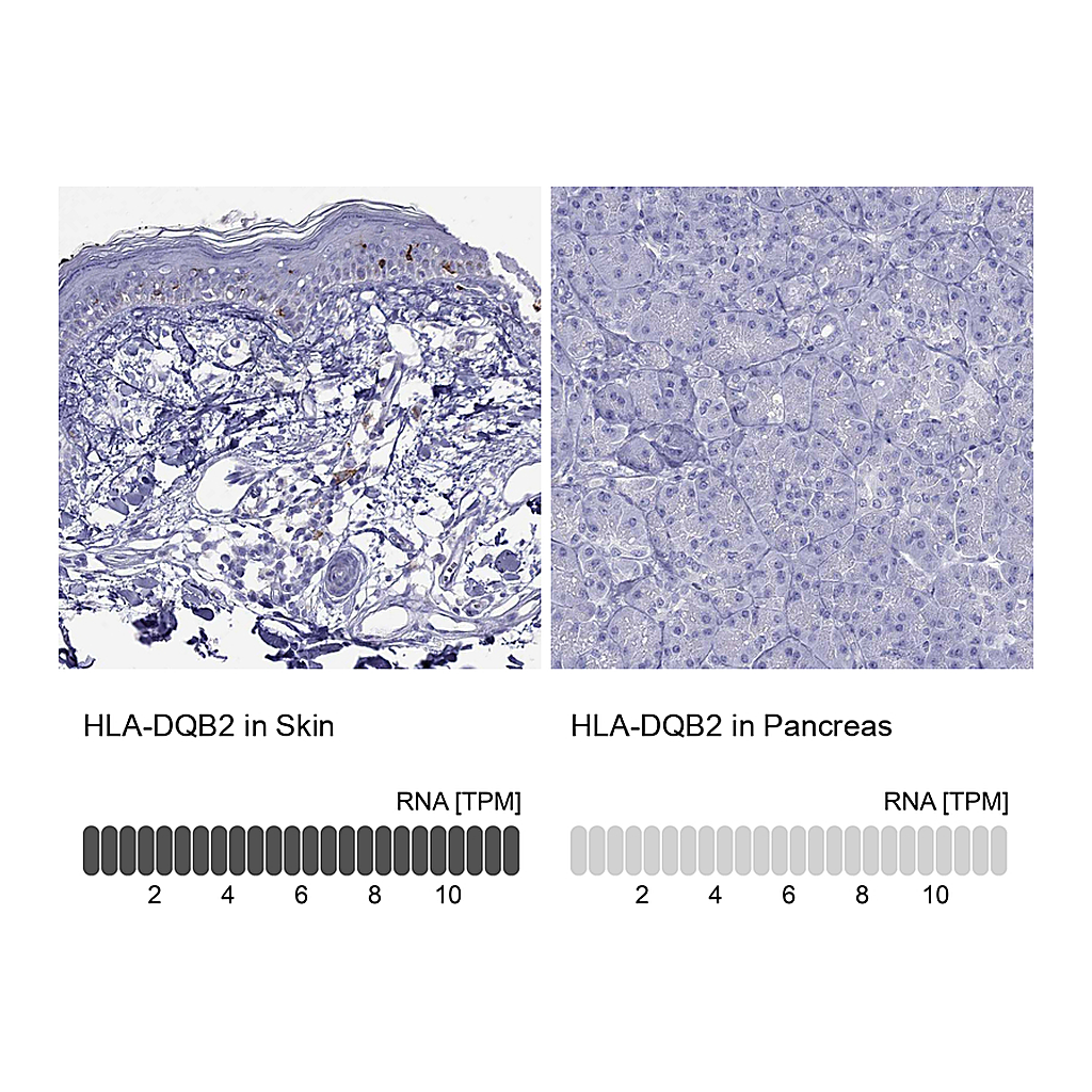Atlas Antibodies Anti-HLA-DQB2 Antibody