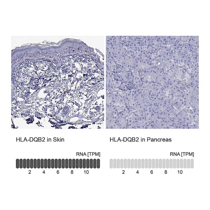 Atlas Antibodies Anti-HLA-DQB2 Antibody