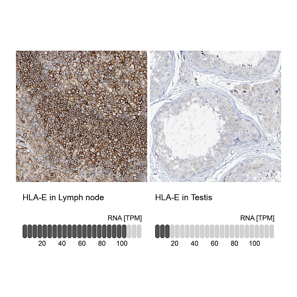 Atlas Antibodies Anti-HLA-E Antibody
