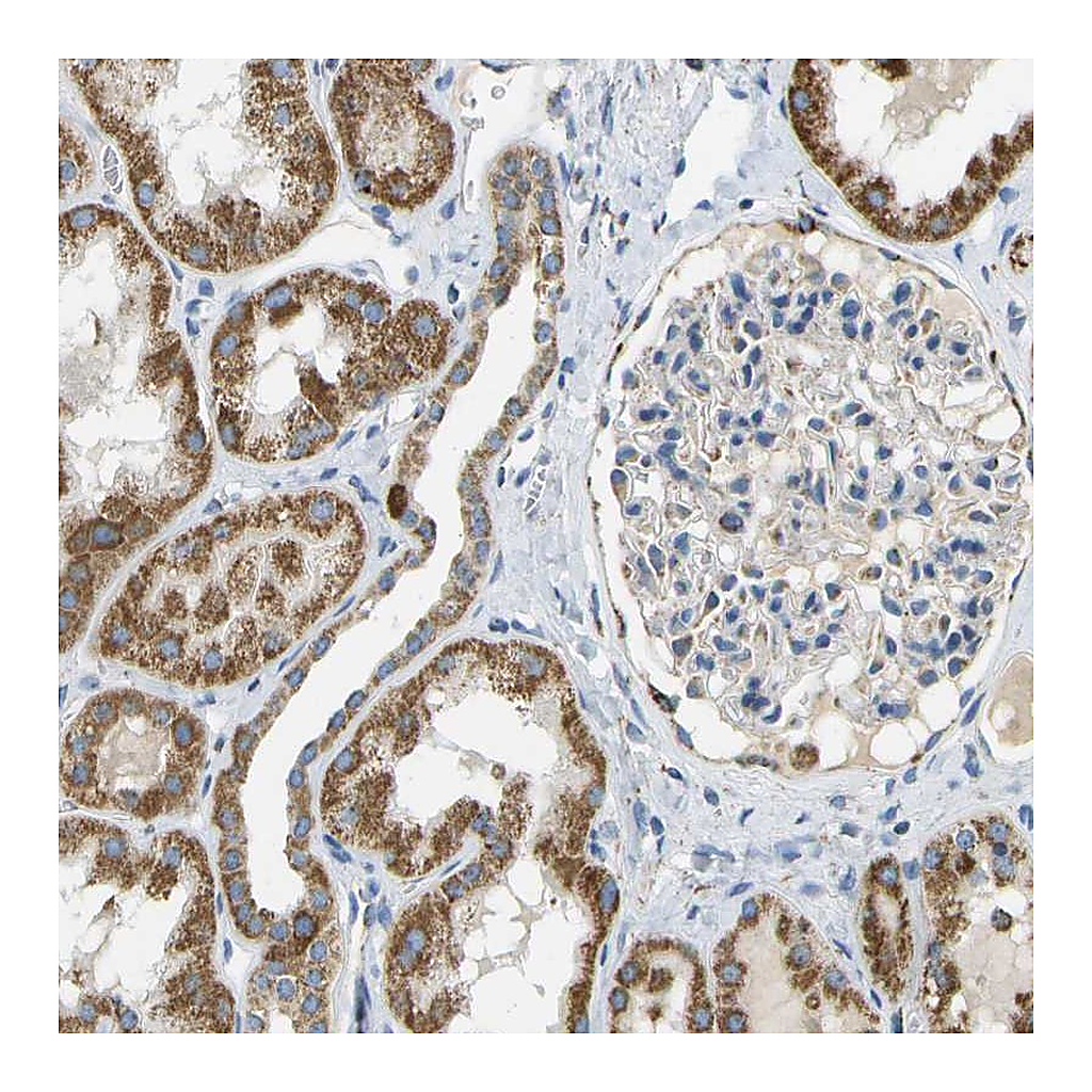 Atlas Antibodies Anti-HLCS Antibody