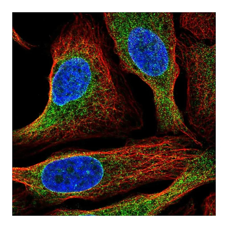 Atlas Antibodies Anti-HM13 Antibody