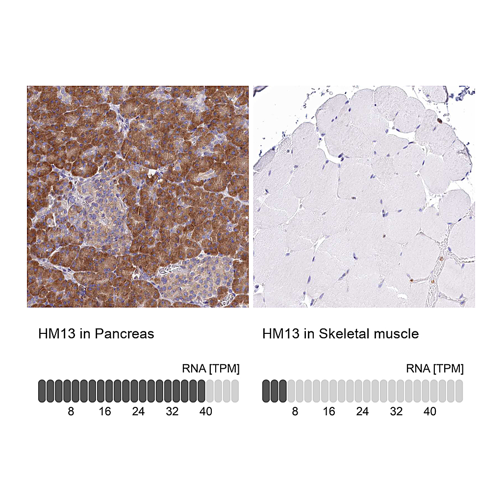 Atlas Antibodies Anti-HM13 Antibody