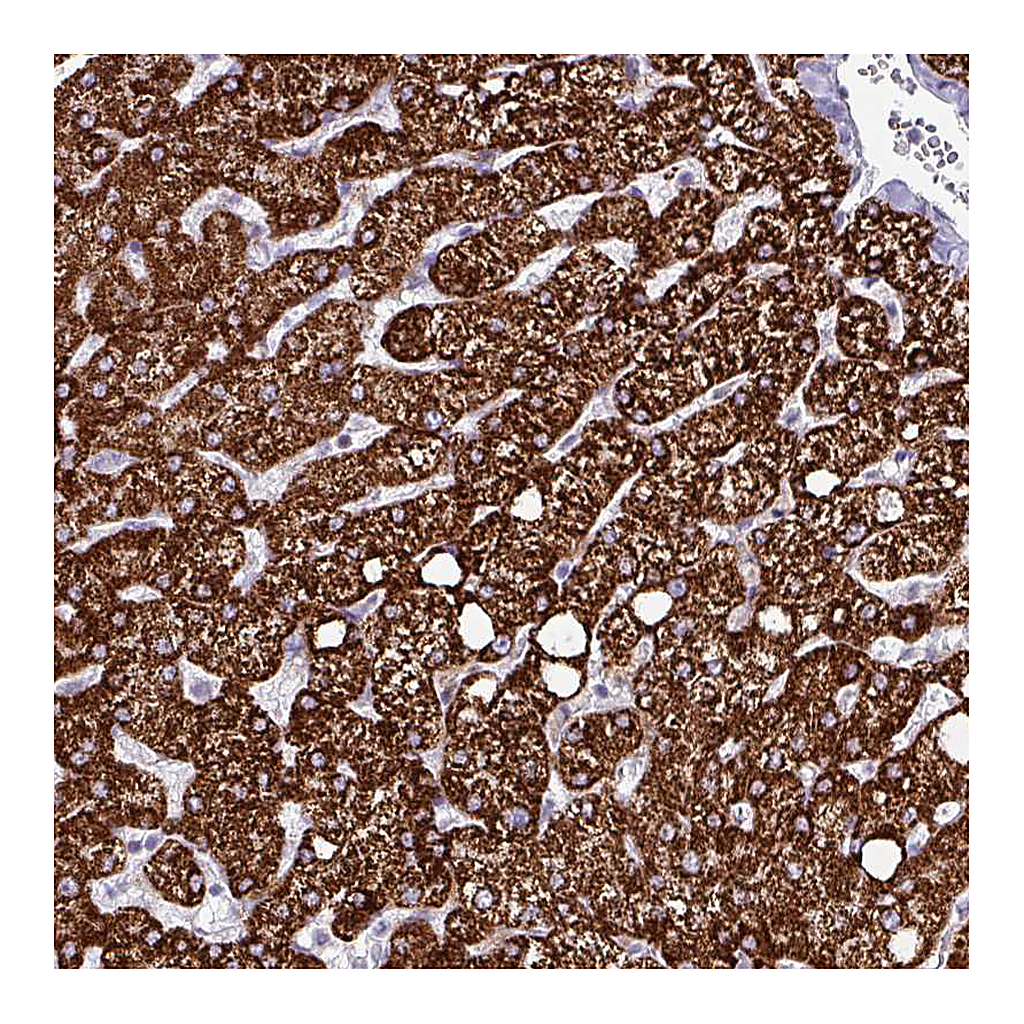 Atlas Antibodies Anti-HMCN1 Antibody