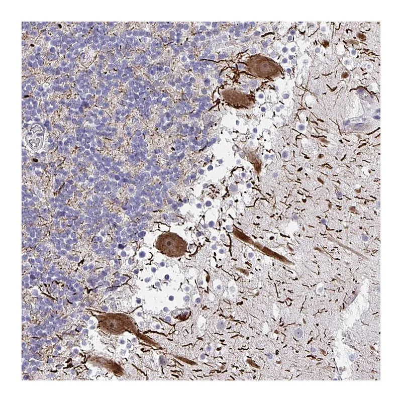 Atlas Antibodies Anti-HMBOX1 Antibody
