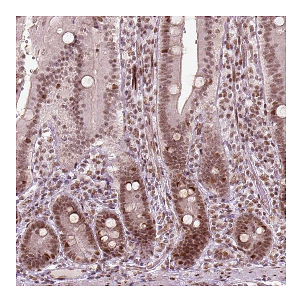 Atlas Antibodies Anti-HMG20B Antibody
