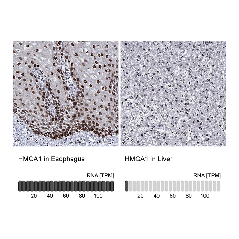 Atlas Antibodies Anti-HMGA1 Antibody
