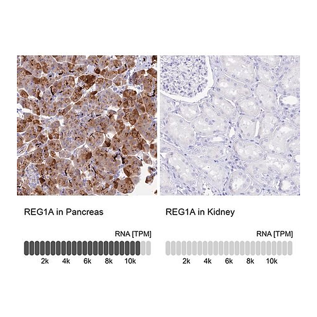 Merck Anti-REG1A antibody produced in rabbit