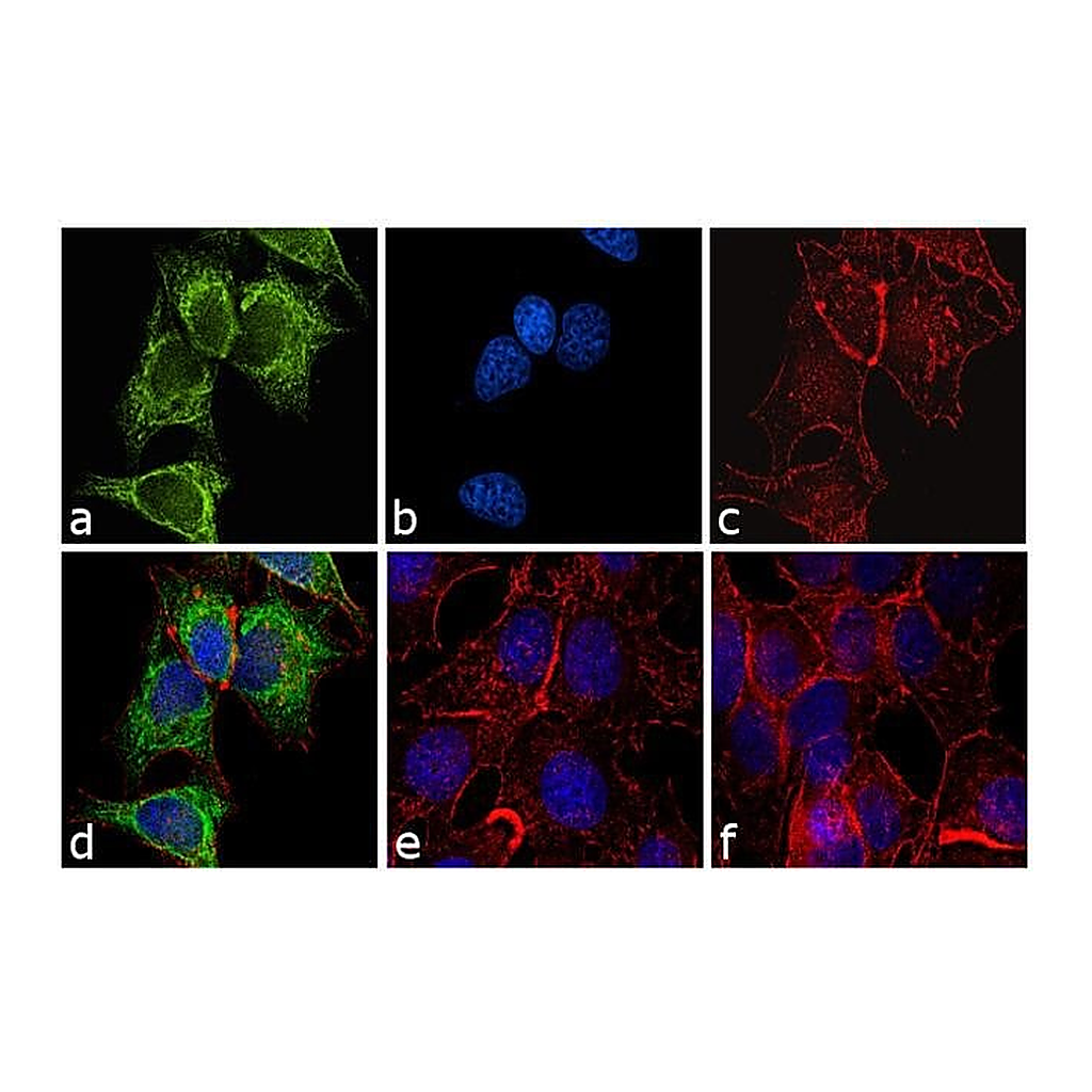 Thermo Fisher Scientific Goat anti-Mouse IgG2a Cross-Adsorbed Secondary Antibody, FITC